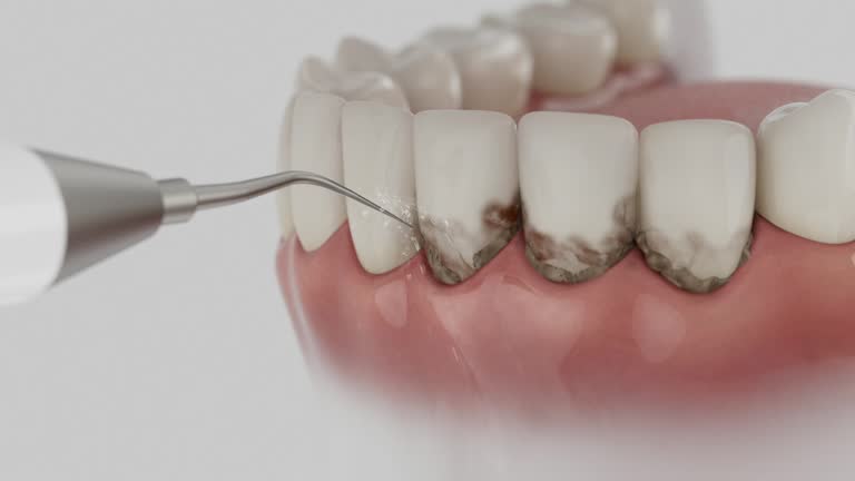 Reliable Dental contractor in Palmyra, MO by Smile Center Dentistry